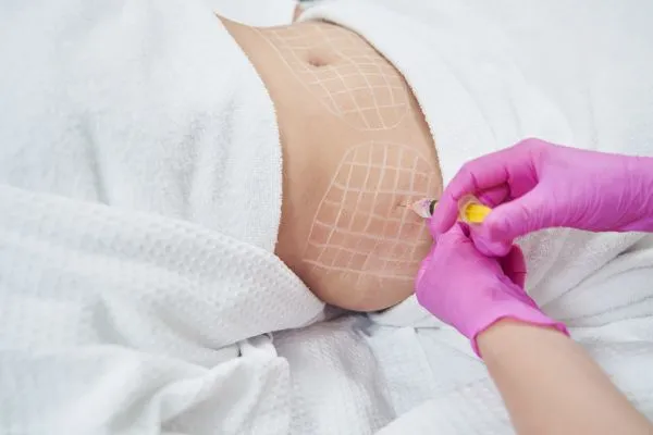 image of fat dissolving injections on love handles to help combat weight gain Rotherham