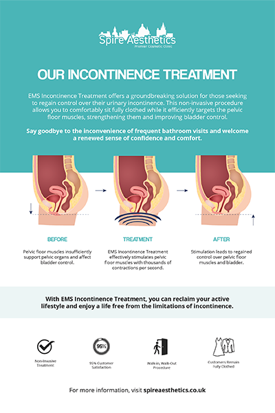 image of how urge incontinence Rotherham treatment works