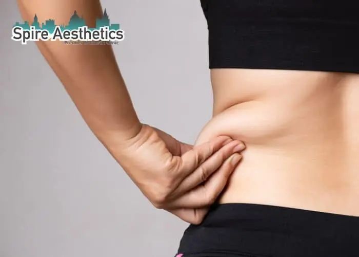 Image of woman pinching fat on their hips Rotherham. Fat Freezing treatment