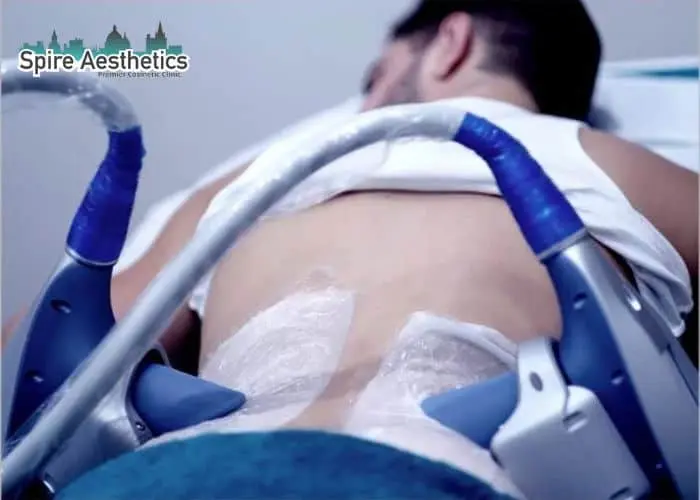 Man having fat freezing treatment done on love handles before a competitions Rotherham to create a sculpted look.