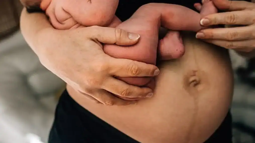Why Is My Stomach Still Big After Pregnancy Rotherham?