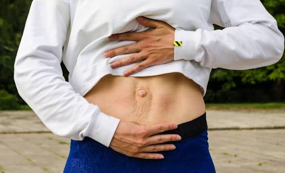 When Could Diastasis Recti Be the Missing Piece of the Puzzle Rotherham?